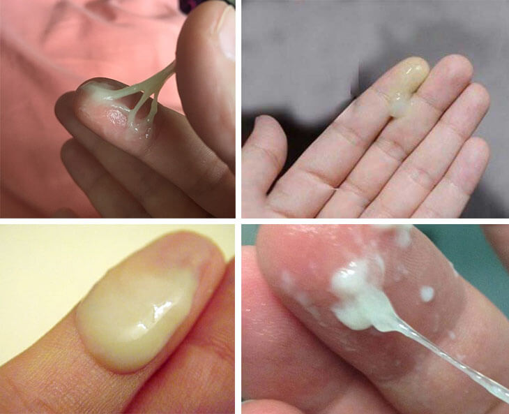 Nước ối có màu gì? Mùi gì? Gallery 2