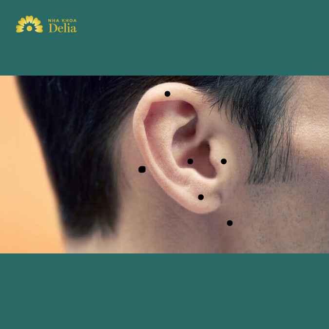 Mụn Ruồi Ở Tai Trái Nam: Ý Nghĩa Và Những Điều Cần Biết