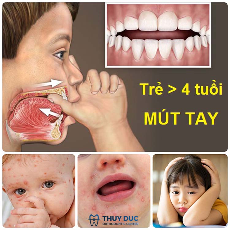 Trẻ Mấy Tháng Biết Mút Tay? Gallery 2