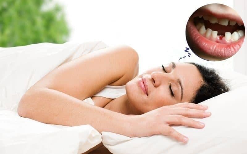 Nằm Mơ Răng Rụng: Điềm Báo Gì? Giải Mã Giấc Mơ Chi Tiết