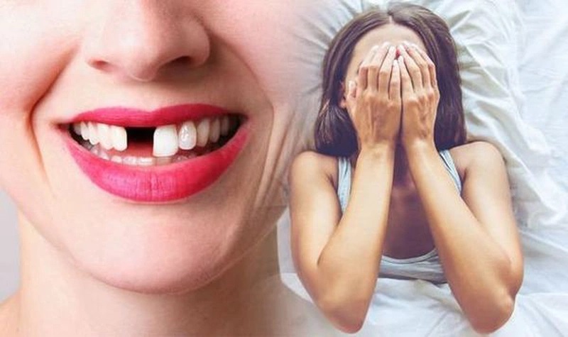 Nằm Mơ Rụng Răng Cửa: Giải Mã Giấc Mơ Và Ý Nghĩa