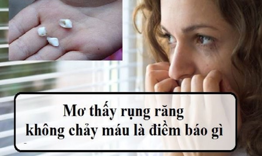 Nằm Mơ Rụng Răng Không Chảy Máu: Điềm Báo Gì?