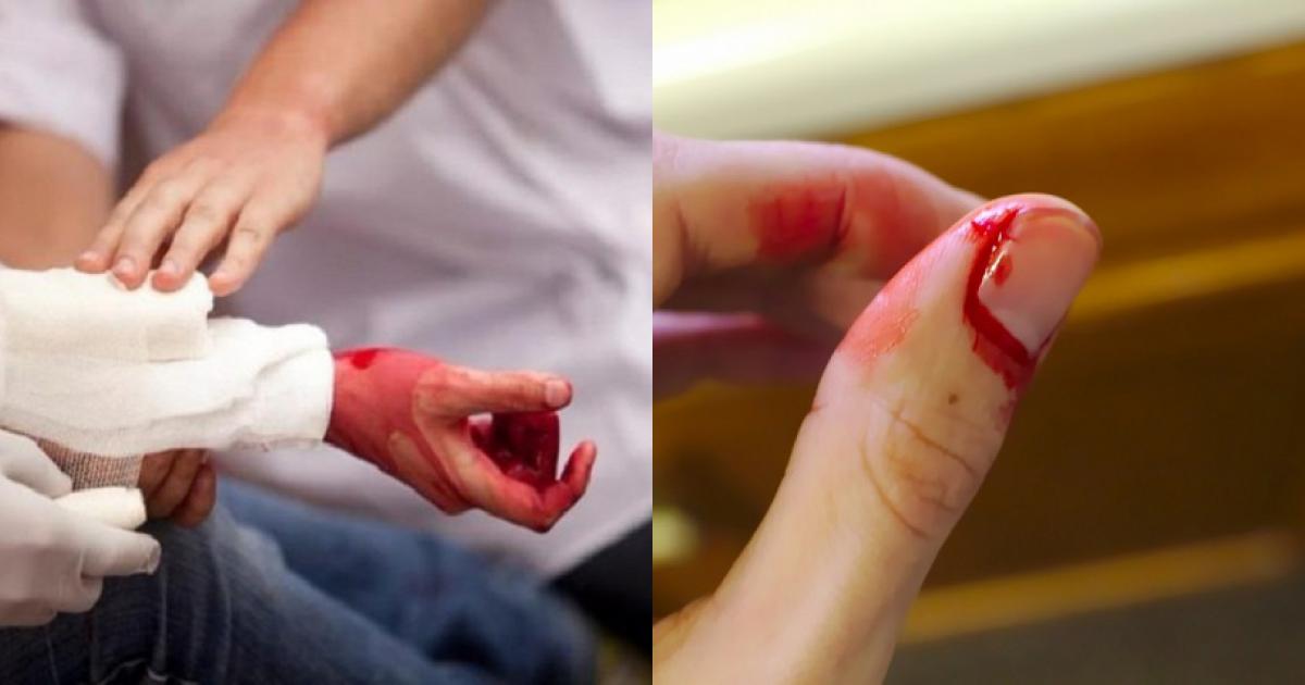 Nằm Mơ Thấy Người Khác Rạch Tay Mình: Điềm Báo Gì?