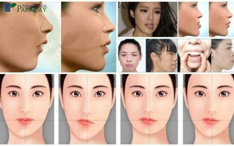 Nằm nghiêng bên trái thì mặt lệch bên nào?