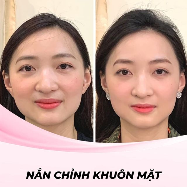 Nắn chỉnh khuôn mặt bằng tay