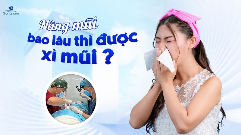 Nâng mũi bao lâu thì được xì mũi?