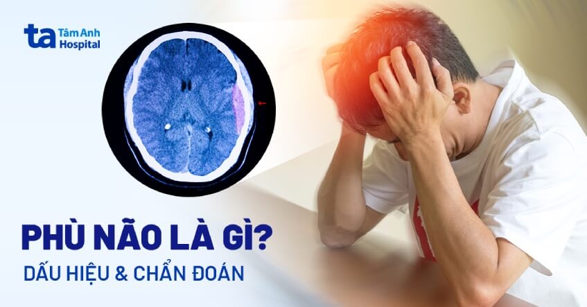 Não nề là gì?