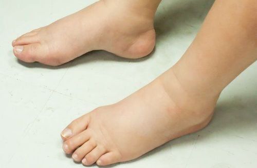 NỀ là gì? Định nghĩa, ý nghĩa và ứng dụng của từ viết tắt NỀ Gallery 2