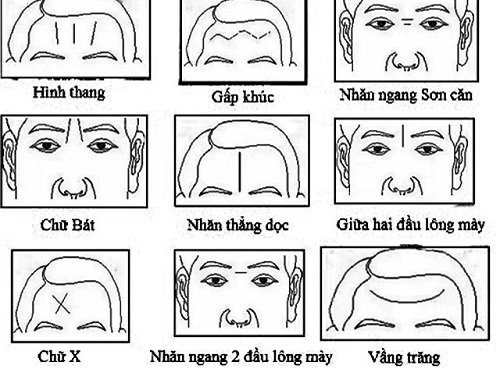 Nếp nhăn trên trán đàn ông: Nguyên nhân, cách phòng ngừa và điều trị