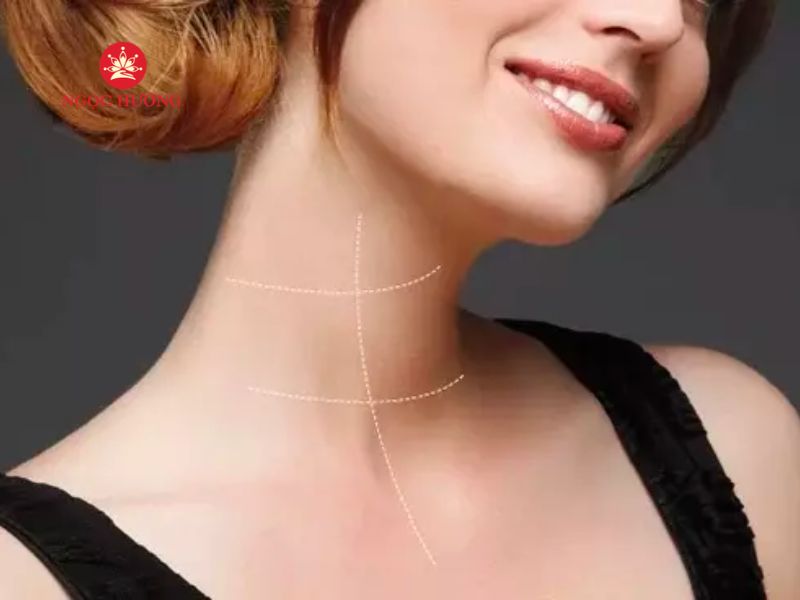 Ngấn Cổ Phú Quý: Bí Quyết Đằng Sau Vẻ Đẹp Và May Mắn Gallery 1