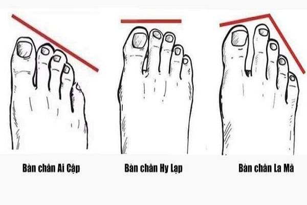 Ngón Chân Giữa Dài Nhất? Nguyên Nhân và Điều Trị