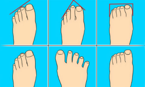 Ngón Chân Xòe Ra: Nguyên Nhân Và Cách Khắc Phục