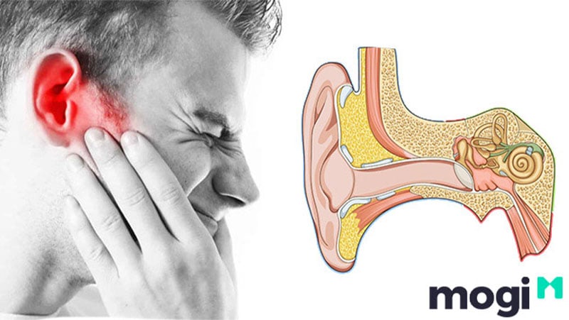 Ngứa Lỗ Tai Phải Là Điềm Gì?