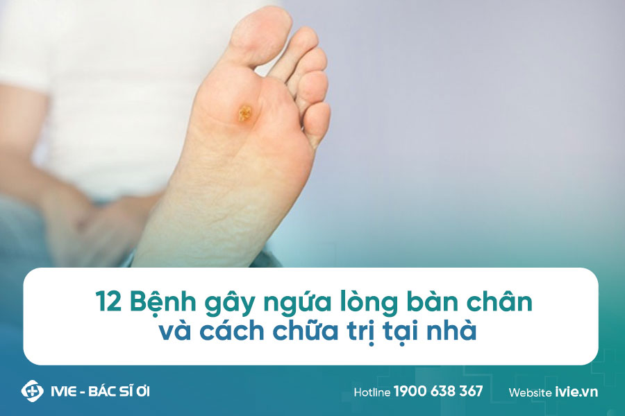 Ngứa Lòng Bàn Chân Trái: Nguyên Nhân và Cách Điều Trị
