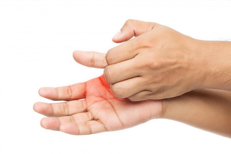 Ngứa lòng bàn tay là điềm gì?