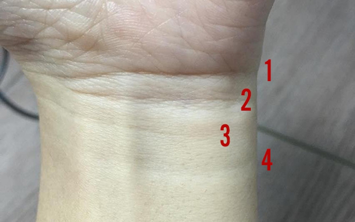 5 Ngấn Cổ Tay: Nguyên Nhân và Cách Khắc Phục