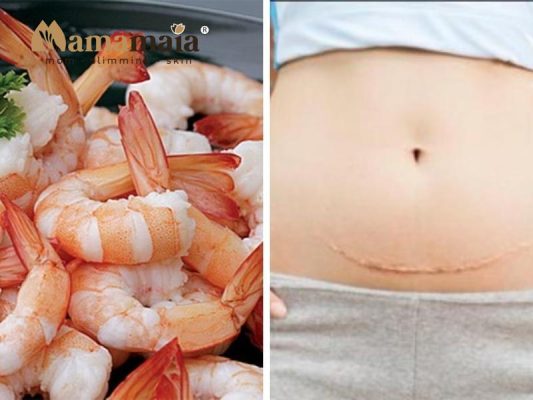 Mổ đẻ có ăn được tôm không? Gallery 1