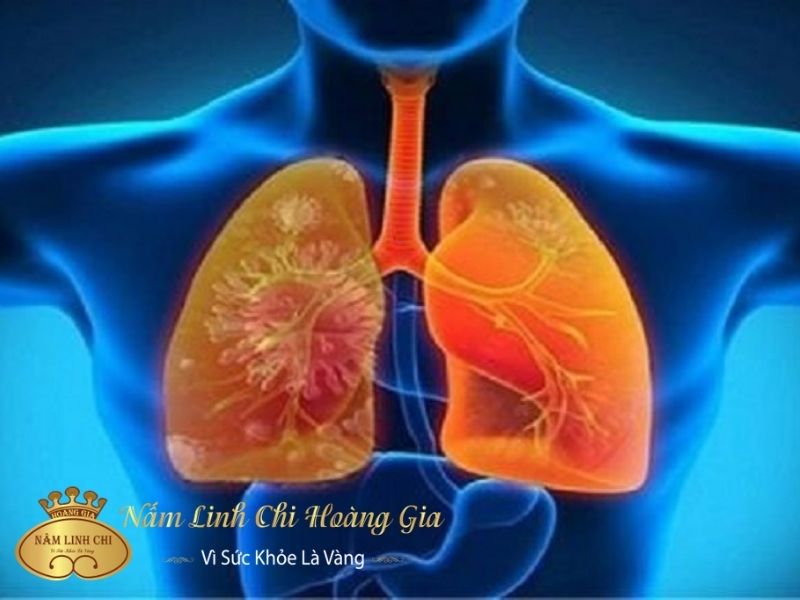 Tác hại của Vaseline giả Gallery 1