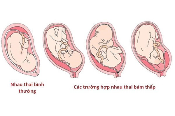 Rau bám thấp có nguy hiểm không? Gallery 1
