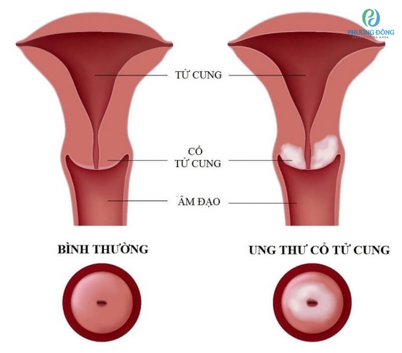 Chảy Máu Hồng Nhạt: Nguyên Nhân và Cách Xử Trí Gallery 1