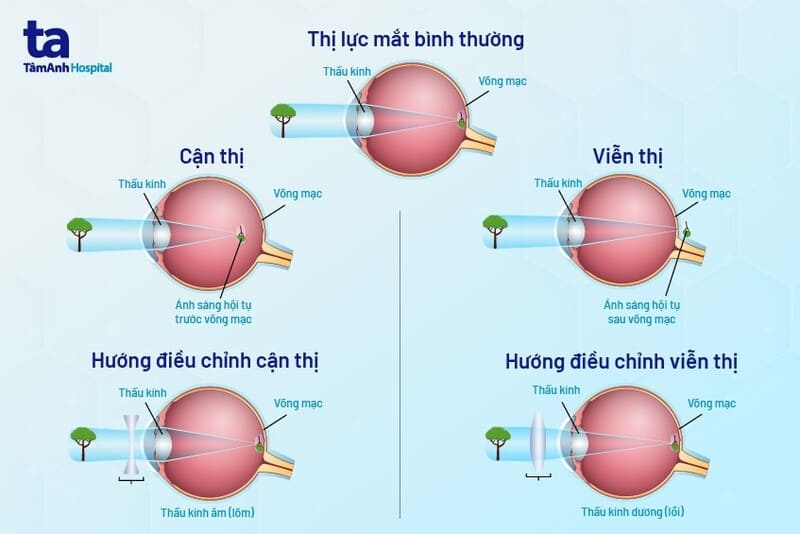 Hiện tượng khúc xạ là gì? Gallery 1