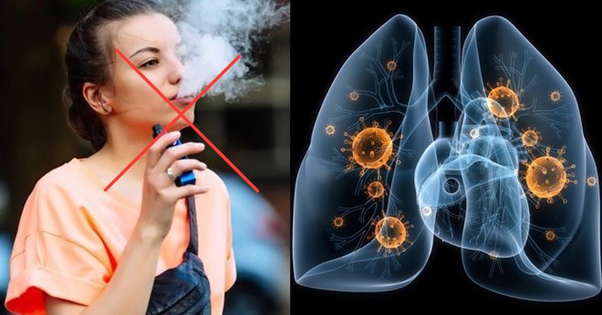 Nguyên nhân của thuốc lá điện tử