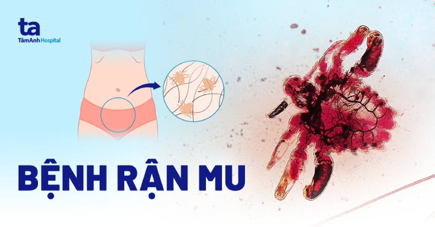 Giận Lẫy Là Gì? Gallery 2