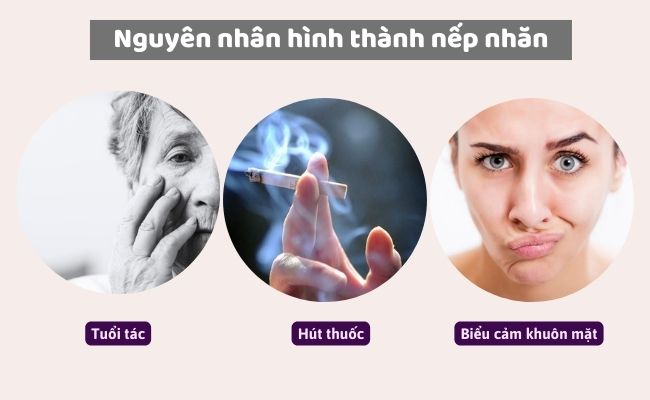 Khép nép là gì? Gallery 1