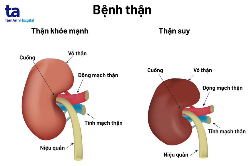 Suy Tình Là Gì? Gallery 2
