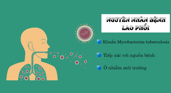 Lao Phổi Là Gì? Gallery 2