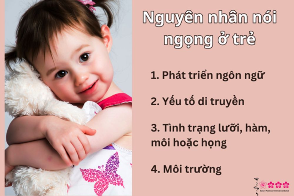Bị Ngọng Là Gì? Gallery 1