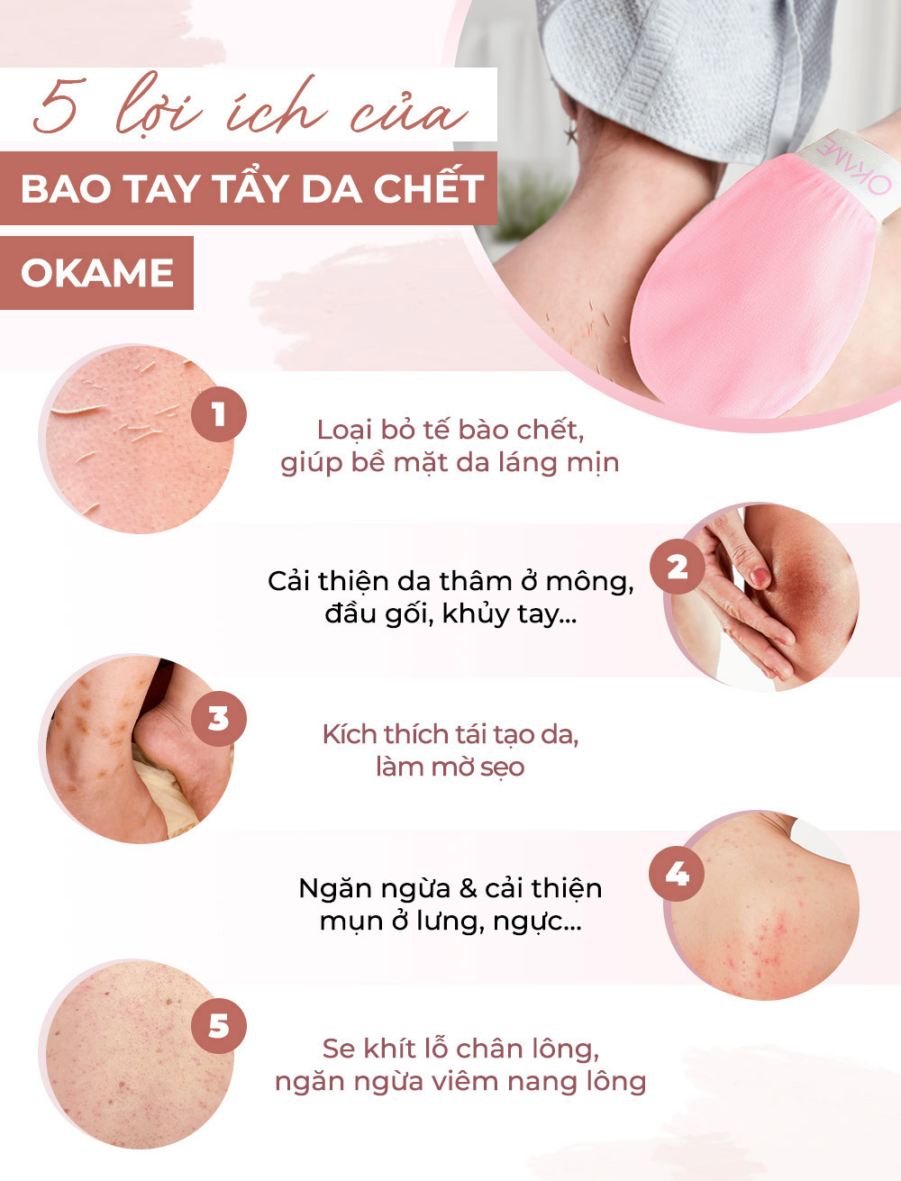 Cách Khắc Phục Cảm Giác Kì Ghét Ở Lưng Gallery 1