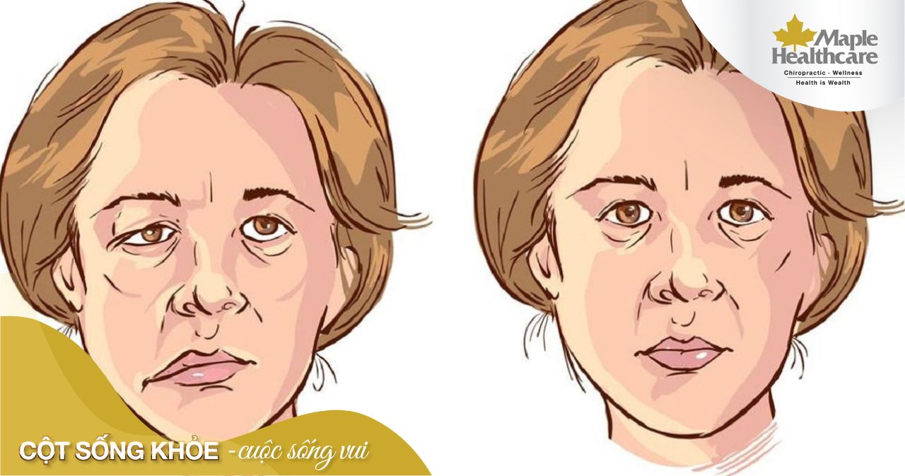 Cảm giác rần rần trên mặt là gì? Nguyên nhân và cách xử lý Gallery 1