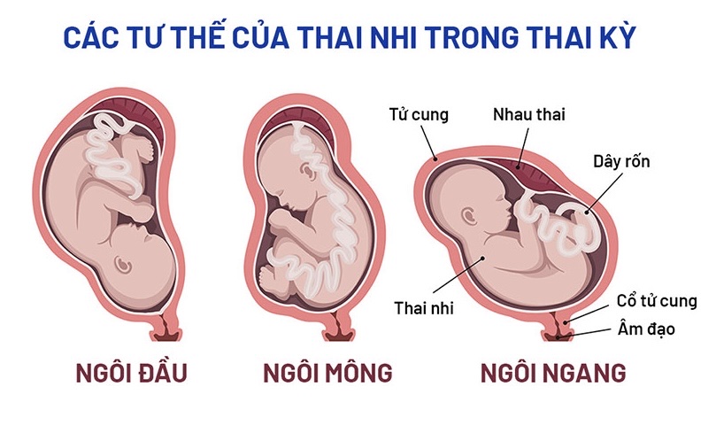 Biểu Hiện Cạn Ối Gallery 2