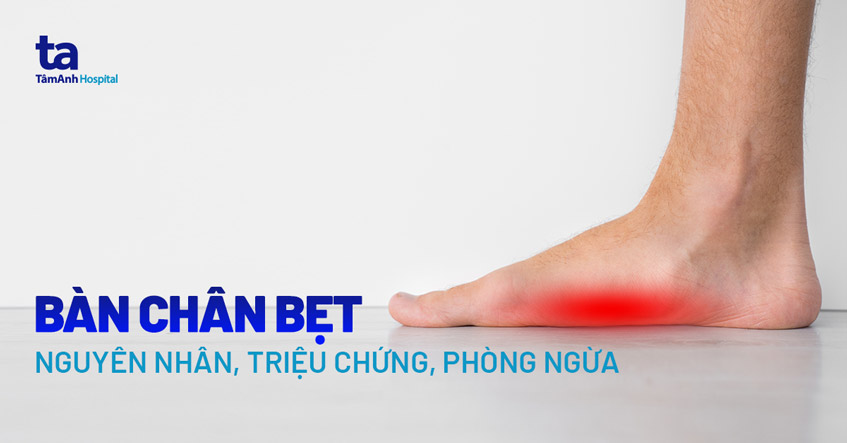 Chân Bẹt Là Gì? Gallery 1