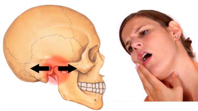 Cứng hàm không há miệng được: Nguyên nhân và cách khắc phục Gallery 1