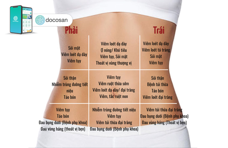 Đau bụng trên rốn: Nguyên nhân và cách xử trí Gallery 1