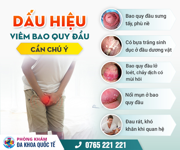 Cậu nhỏ bị đau buốt: Nguyên nhân và cách khắc phục Gallery 1