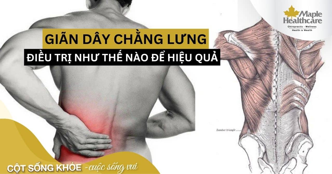 Đau Dây Chằng Lưng: Nguyên Nhân, Triệu Chứng Và Cách Điều Trị Gallery 1