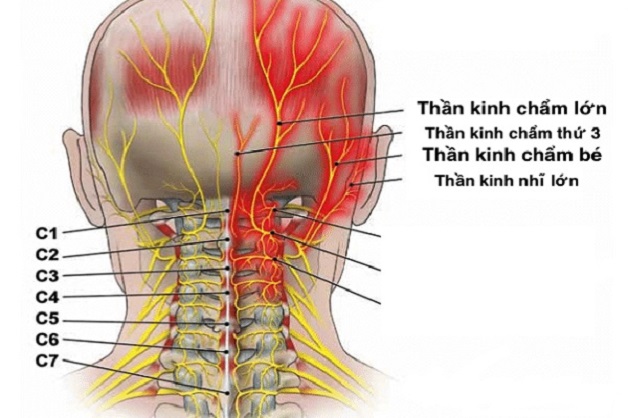 Đau Nửa Đầu Bên Trái Gallery 1