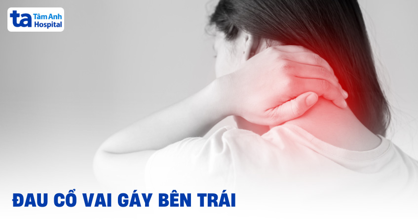 Cách Chữa Đau Vai Gáy Bên Trái Gallery 1