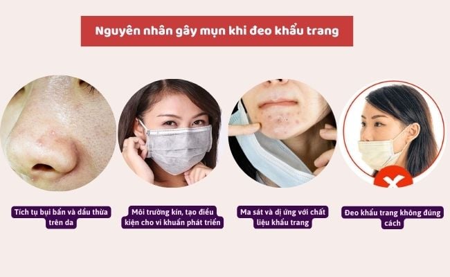 Dị ứng khẩu trang: Nguyên nhân, triệu chứng và cách khắc phục Gallery 1