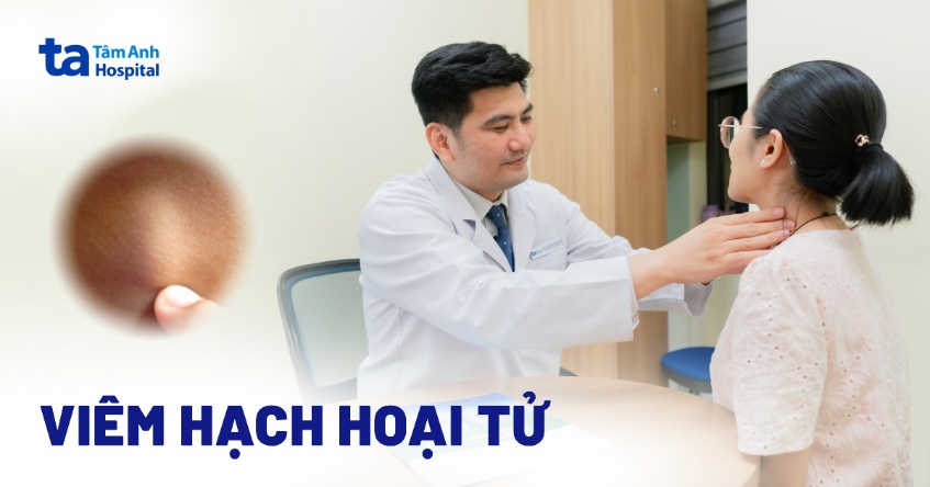 Hạch Hoại Tử Là Gì? Gallery 1