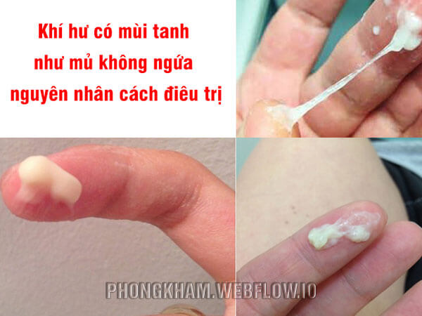 Khí hư có mùi hôi tanh: Nguyên nhân và cách khắc phục Gallery 1