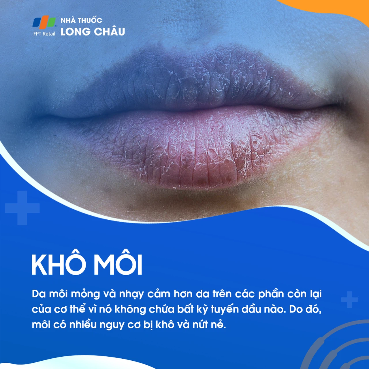 Môi bị khô sần: Nguyên nhân, cách khắc phục và phòng ngừa Gallery 1
