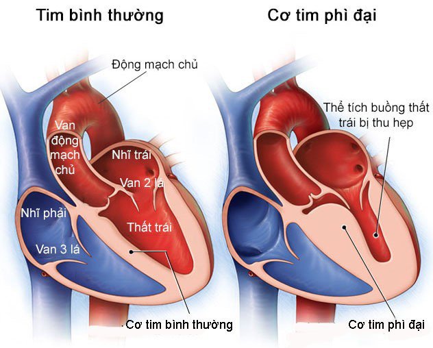Lịm tim là gì? Gallery 1