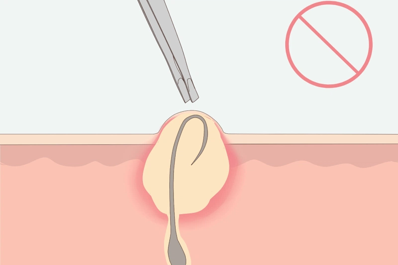 Lông Chân Bị Cuộn Tròn: Nguyên Nhân Và Cách Khắc Phục Gallery 1