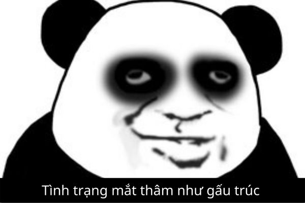 Mắt Thâm Như Gấu Trúc: Nguyên Nhân và Cách Khắc Phục Gallery 1