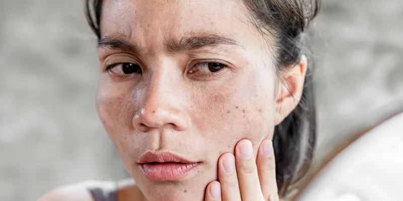 Tự Nhiên Mọc Lông Đen Trên Mặt: Nguyên Nhân Và Cách Khắc Phục Gallery 1