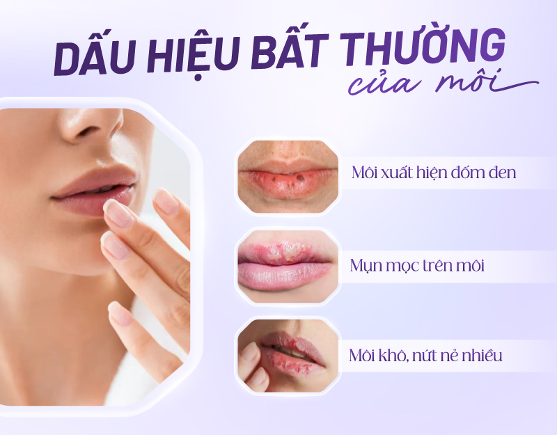 Môi nhợt nhạt phải làm sao? Gallery 1
